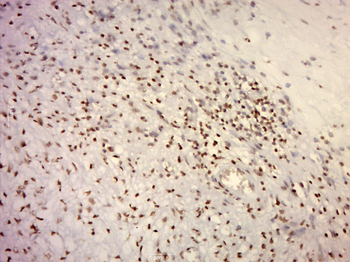 Histone H3 (acetyl K9) Mouse Monoclonal Antibody