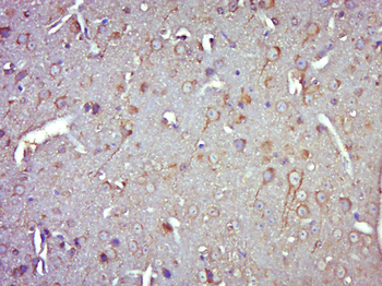 Phospho-Serine Mouse Monoclonal Antibody