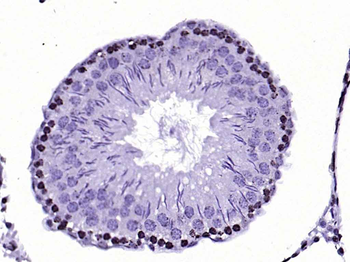 Histone H3 (tri methyl K4) Mouse Monoclonal Antibody