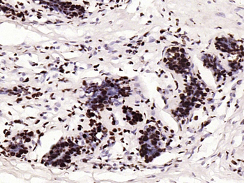 Histone H3 (tri methyl K79) Mouse Monoclonal Antibody