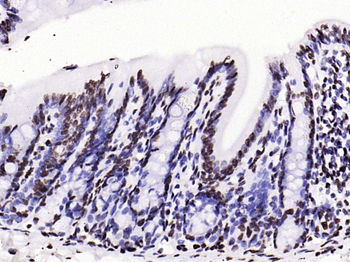 Histone H3 (tri methyl K79) Mouse Monoclonal Antibody