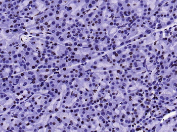 Histone H3 (tri methyl K79) Mouse Monoclonal Antibody