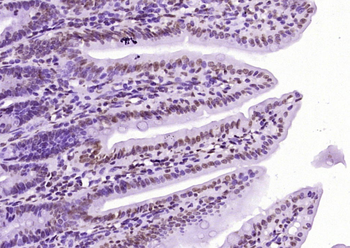 Histone H3 (tri methyl K79) Mouse Monoclonal Antibody