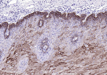 CK17 Mouse Monoclonal Antibody