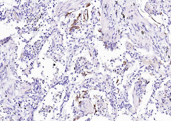 CK17 Mouse Monoclonal Antibody