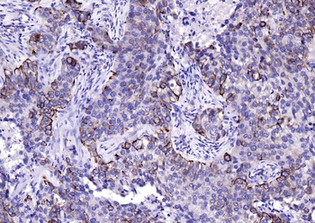 CK17 Mouse Monoclonal Antibody