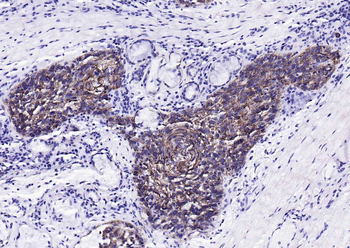 CK17 Mouse Monoclonal Antibody