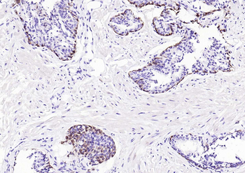 CK17 Mouse Monoclonal Antibody