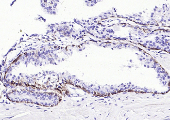 CK17 Mouse Monoclonal Antibody
