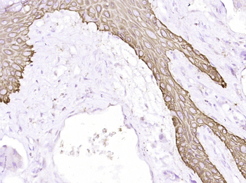 CK17 Mouse Monoclonal Antibody