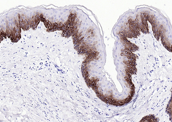 CK17 Mouse Monoclonal Antibody