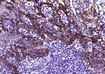 CK17 Mouse Monoclonal Antibody