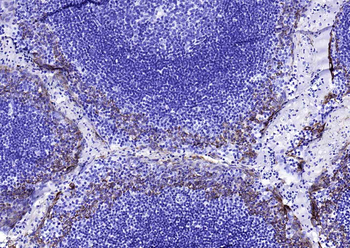 CK17 Mouse Monoclonal Antibody