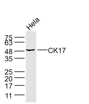 CK17 Mouse Monoclonal Antibody