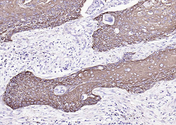 CK17 Mouse Monoclonal Antibody