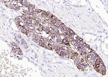 CK17 Mouse Monoclonal Antibody