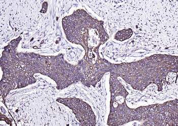 CK17 Mouse Monoclonal Antibody