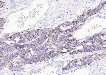 CK17 Mouse Monoclonal Antibody