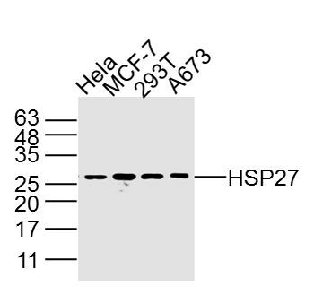 HSP27 Mouse Monoclonal Antibody