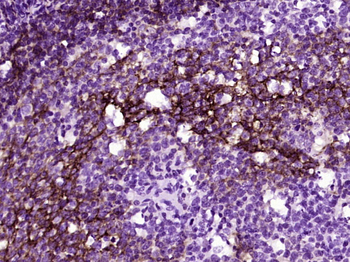 CD23 Mouse Monoclonal Antibody