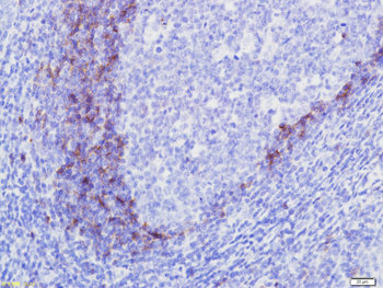 CD23 Mouse Monoclonal Antibody
