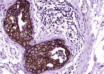 C-erbB-2/HER2 Mouse Monoclonal Antibody