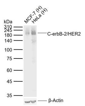 C-erbB-2/HER2 Mouse Monoclonal Antibody