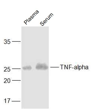 TNF alpha Mouse Monoclonal Antibody