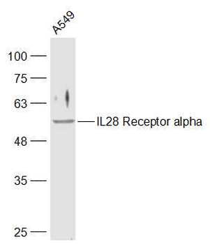 IL28 Receptor alpha Rabbit Polyclonal Antibody