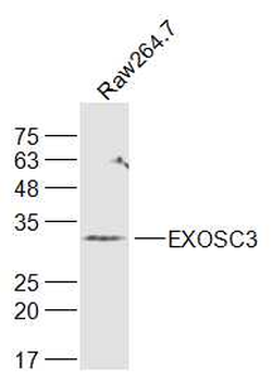 EXOSC3 Rabbit Polyclonal Antibody