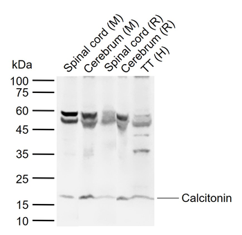 Calcitonin Rabbit Polyclonal Antibody