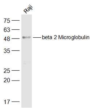 Beta 2 Microglobulin Rabbit Polyclonal Antibody