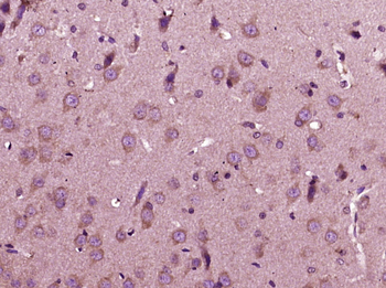 IL12A Rabbit Polyclonal Antibody