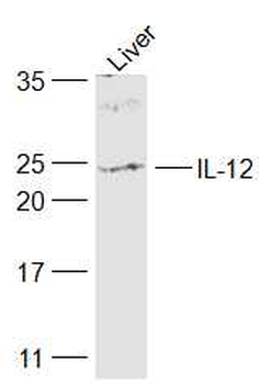 IL12A Rabbit Polyclonal Antibody
