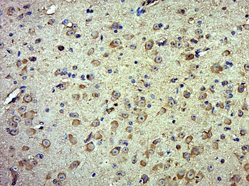 PYCR1 Rabbit Polyclonal Antibody