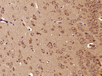 Cathepsin L (heavy chain) Rabbit Polyclonal Antibody