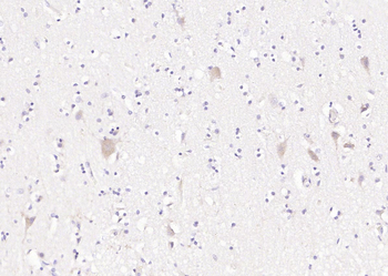 Phospho-SMAD7 (Ser249) Rabbit Polyclonal Antibody