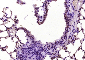 Phospho-SMAD7 (Ser249) Rabbit Polyclonal Antibody