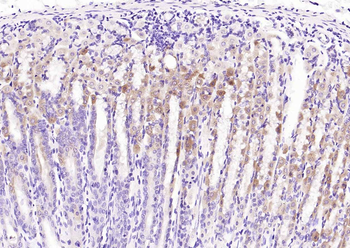 Phospho-SMAD7 (Ser249) Rabbit Polyclonal Antibody