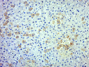SERPIN A11 Rabbit Polyclonal Antibody