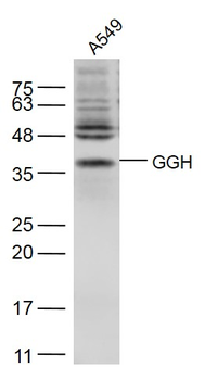 GGH Rabbit Polyclonal Antibody