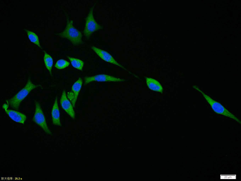 Smac Rabbit Polyclonal Antibody