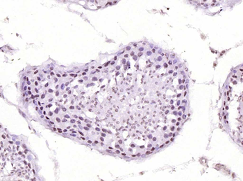 FGF2 Rabbit Polyclonal Antibody