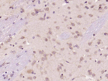 FGF2 Rabbit Polyclonal Antibody