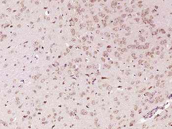 Cathepsin D Rabbit Polyclonal Antibody