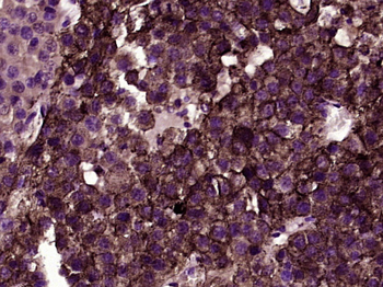 NG2 Rabbit Polyclonal Antibody