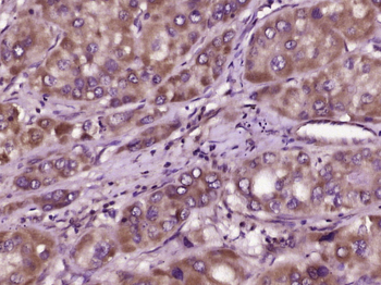 DcR3 Rabbit Polyclonal Antibody