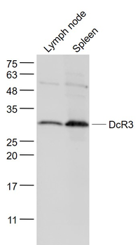 DcR3 Rabbit Polyclonal Antibody
