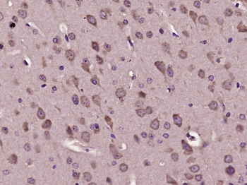 LTA4H Rabbit Polyclonal Antibody