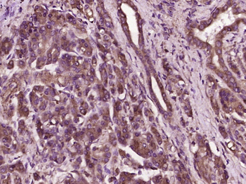 Prokineticin 1 Rabbit Polyclonal Antibody